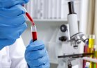 Varian Baru HIV yang Lebih Ganas dan Menular Terdeteksi di Belanda