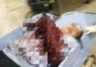 Oknum Polisi Bacok Wanita di Merauke, Kedua Tangannya Cacat dan Nyaris Diamputasi