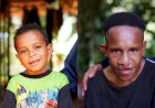 TSE Group Hadir Membawa Kebahagiaan dan Harapan Baru Bagi Kehidupan Anak-Anak Papua Penderita Bibir Sumbing Pasca Operasi